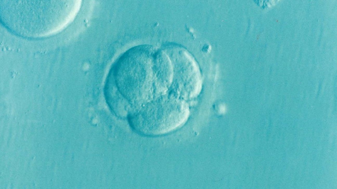 imagen Cómo la inteligencia artificial está transformando los tratamientos de fertilidad
