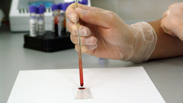 imagen Avanza el test rápido creado por investigadoras argentinas para detectar el cáncer de mama