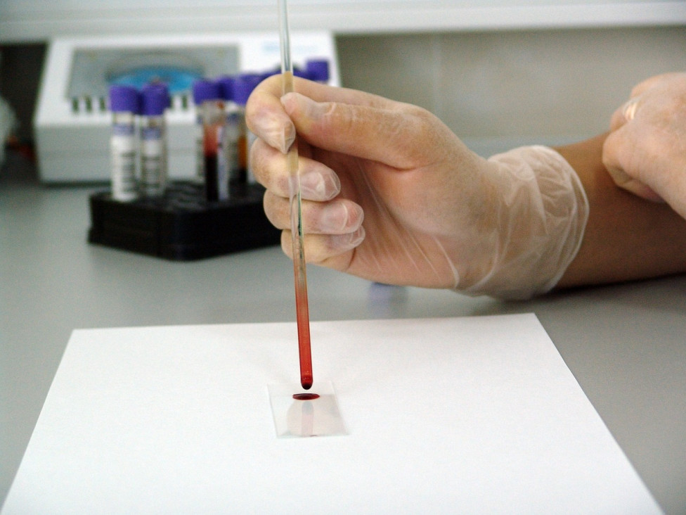 imagen Avanza el test rápido creado por investigadoras argentinas para detectar el cáncer de mama