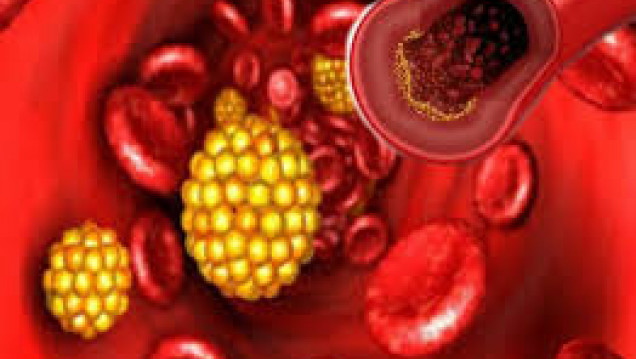 imagen Factores de riesgo: triglicéridos y colesterol alto
