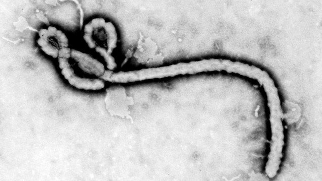 imagen Ébola: "En Argentina estamos preparados a través de los protocolos del Ministerio de Salud", afirmó la Dra. Atorri