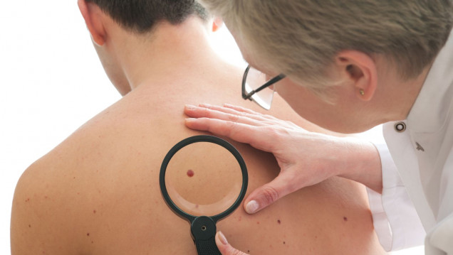 imagen Campaña de prevención de cáncer de piel