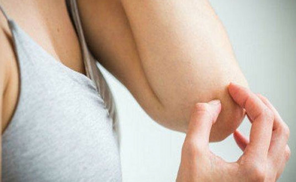 imagen Día Mundial de la Psoriasis: una enfermedad del sistema inmune