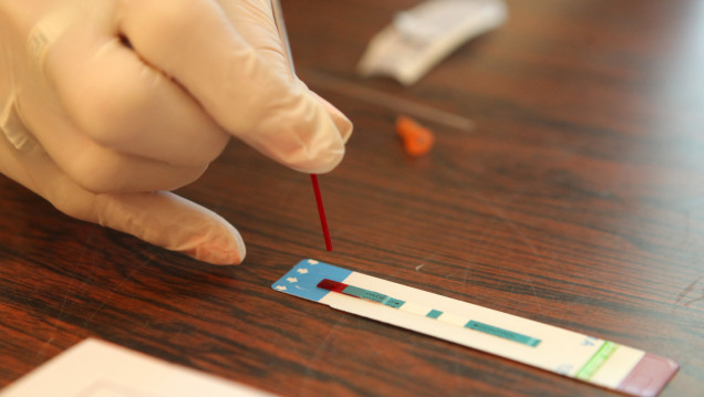 imagen VIH-Sida, una epidemia estable que necesita prevención