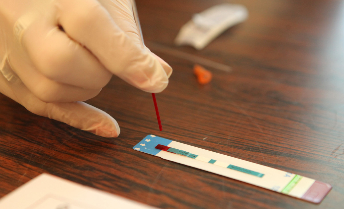 imagen VIH-Sida, una epidemia estable que necesita prevención