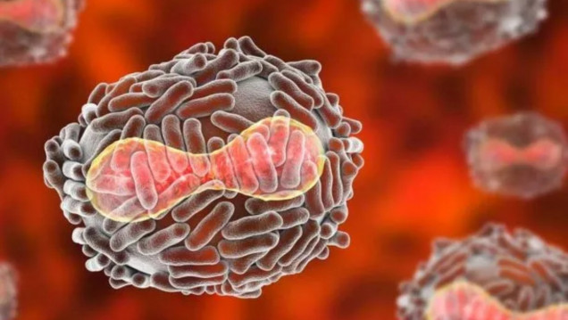 imagen La viruela del mono y sus diferencias con la viruela humana