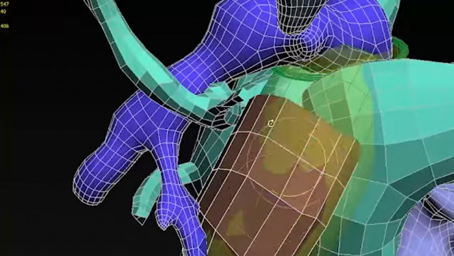 imagen La UNCUYO y el Hospital Lencinas realizarán prótesis con tecnología 3D