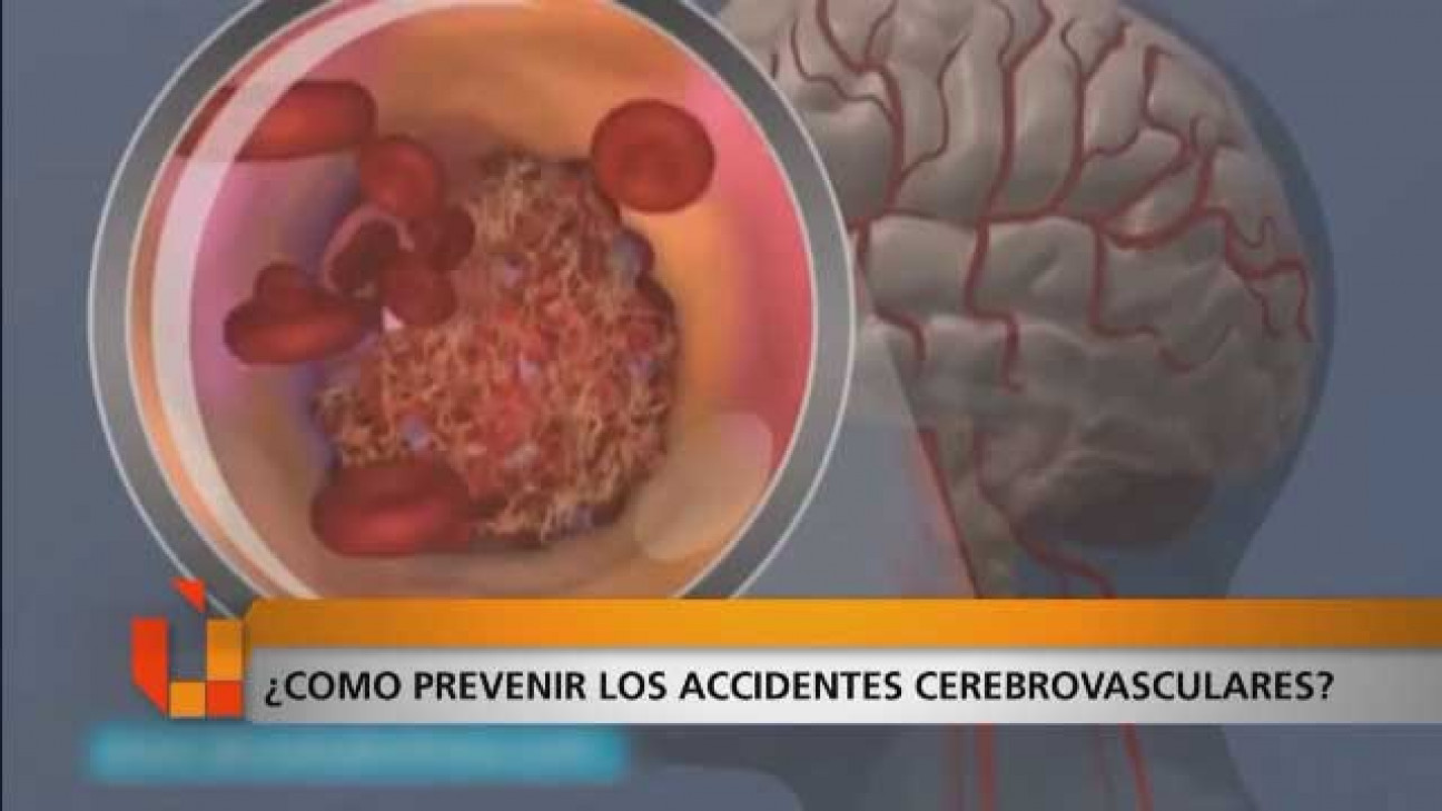 imagen Prevención de los ACV