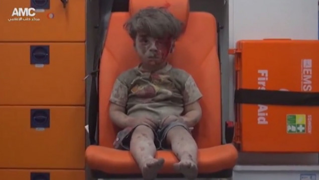 imagen Omran, otro niño sirio herido que muestra el drama de los bombardeos