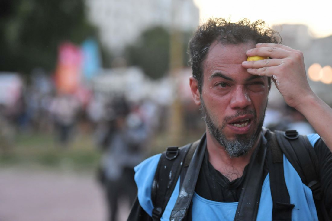imagen Alerta por trabajadores de prensa heridos durante la represión frente al Congreso 