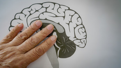 imagen Investigadores del Conicet aportan nuevas pistas para mejorar las terapias del Parkinson a largo plazo