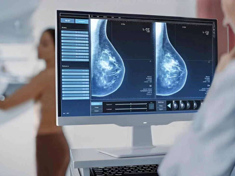 imagen Cáncer de mama: una nueva terapia inhibe el crecimiento de tumores