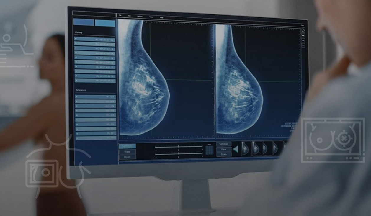 imagen Estudian cómo la IA aporta mayor precisión en el diagnóstico del cáncer de mama