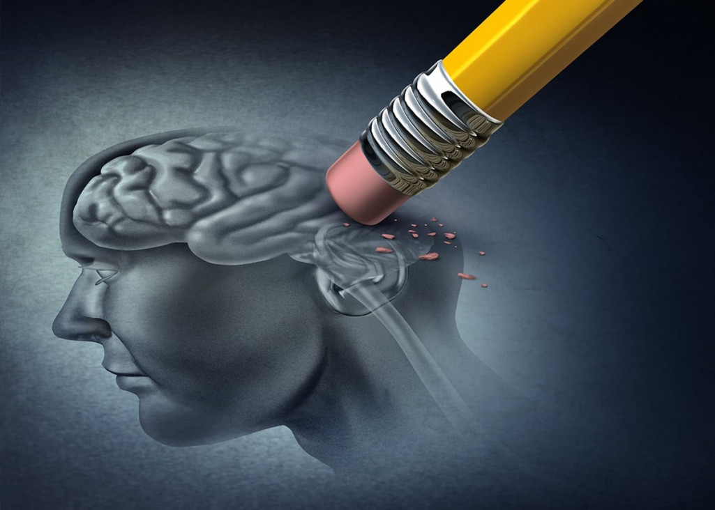 imagen Diseñan un modelo que simula la actividad cerebral para ensayar tratamientos de enfermedades neurodegenerativas
