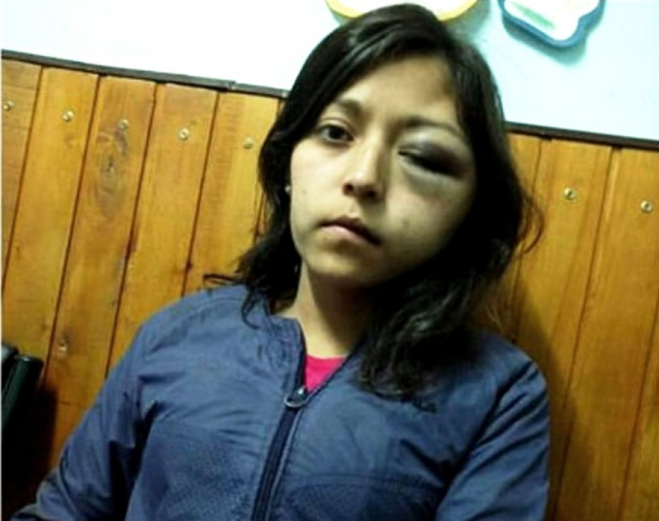 imagen Detuvieron al acusado de desfigurar a su expareja