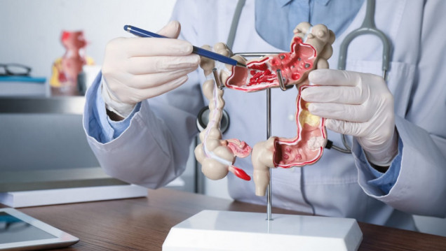 imagen Estudian un tratamiento que bloquea el crecimiento del cáncer colorrectal en estadios avanzados