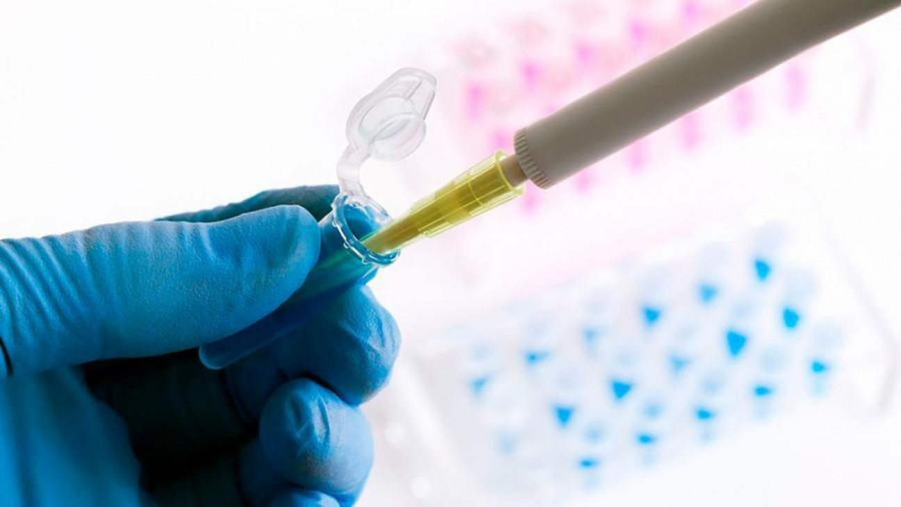 imagen Mendoza suma 12 casos positivos por coronavirus