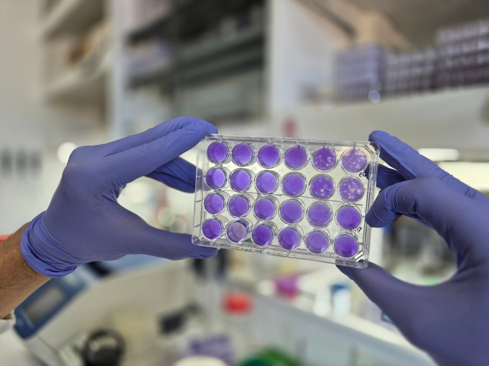 imagen Hallan un mecanismo común de replicación para los virus del dengue, Zika y fiebre amarilla