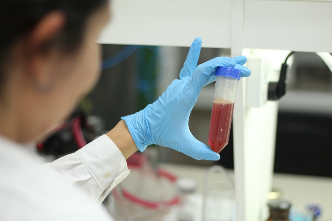 imagen Buscan fortificar alimentos de consumo masivo con agentes anticancerígenos 