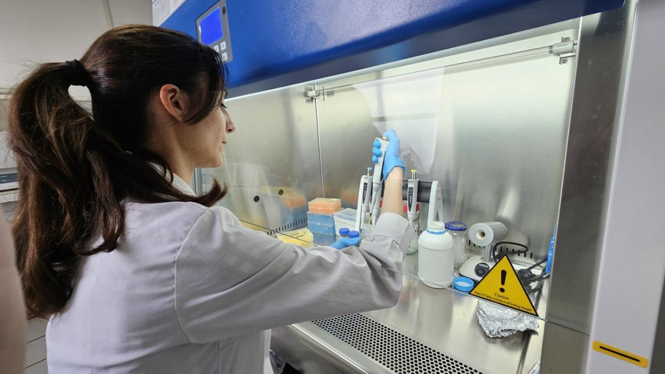 imagen Avanza el test nacional para la detección del hongo que afecta a personas inmunosuprimidas