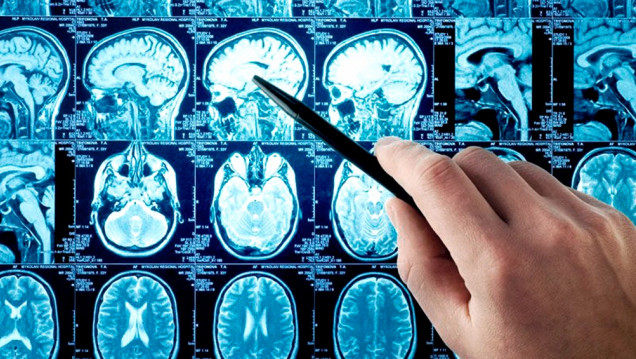 imagen Científicos argentinos crearon un asistente virtual móvil para reconocer síntomas de ACV