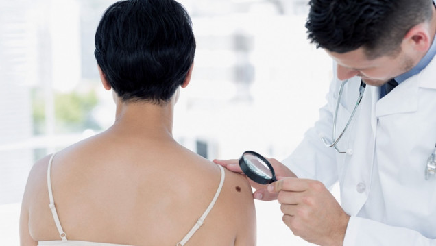 imagen Controlar lunares, el eje de una nueva campaña contra el melanoma