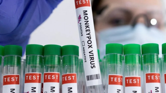 imagen El Ministerio de Salud confirmó el primer caso argentino de la viruela del mono