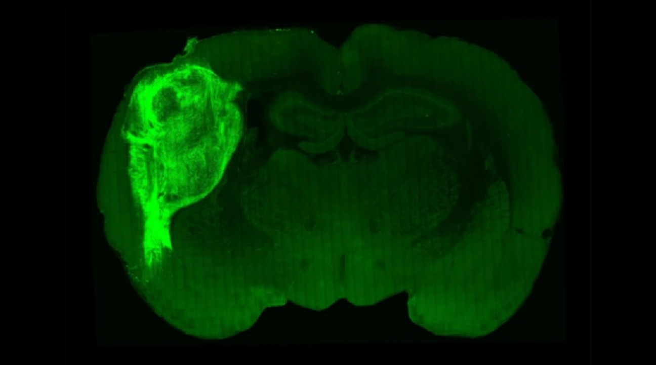 imagen Científicos instalaron células cerebrales en ratas para estudiar los trastornos psiquiátricos