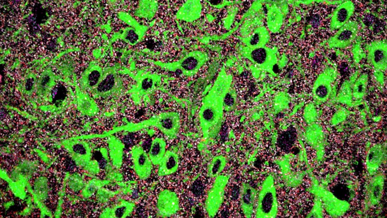imagen Identifican un mecanismo del neurodesarrollo cuya alteración contribuiría al origen de trastornos mentales