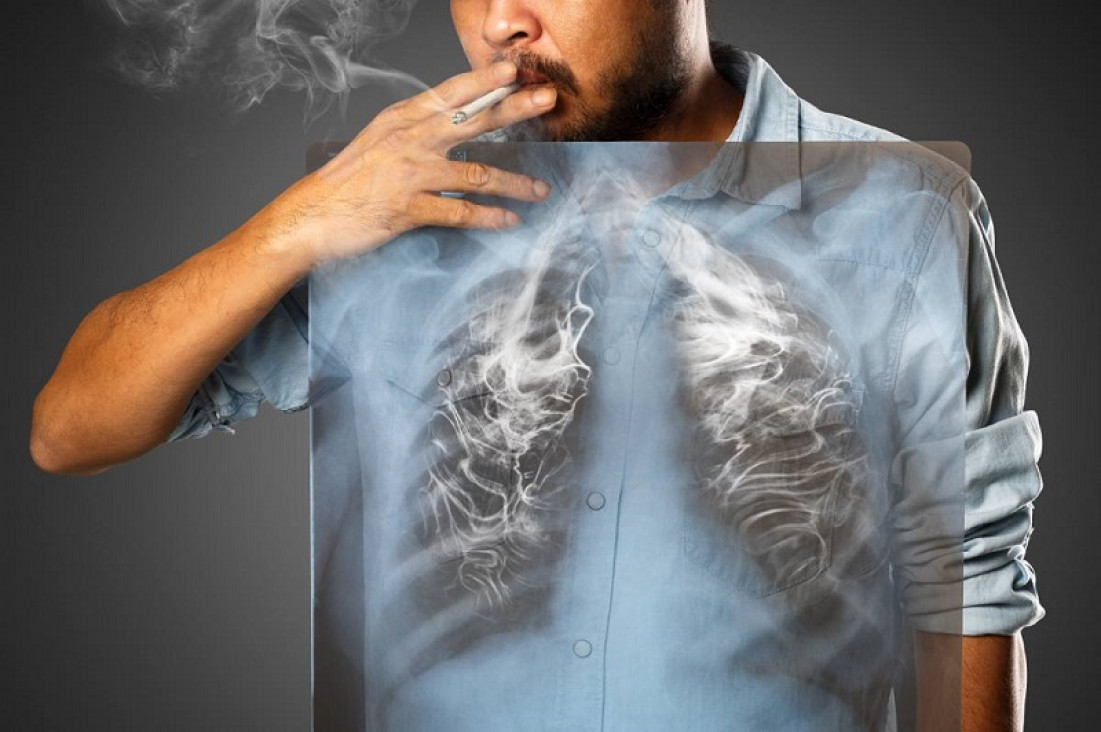 imagen En Argentina, hay casi 45 mil muertos por año debido al consumo de tabaco