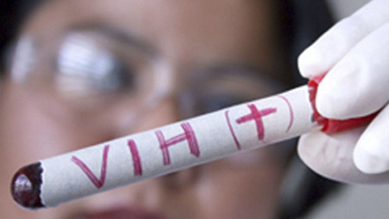 imagen Mendoza ya utiliza un nuevo método para prevenir el VIH 