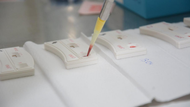 imagen Dónde te podés hacer el test rápido del VIH
