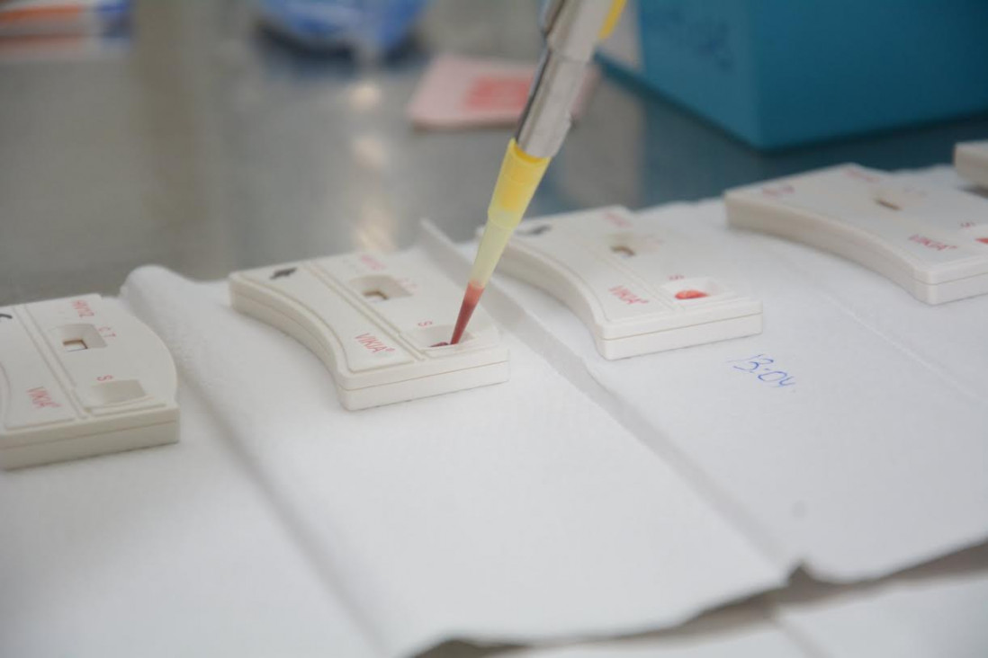 imagen Dónde te podés hacer el test rápido del VIH